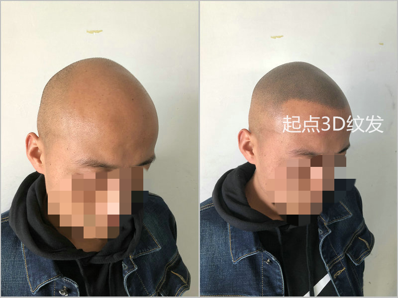 淮安起点纹发作品