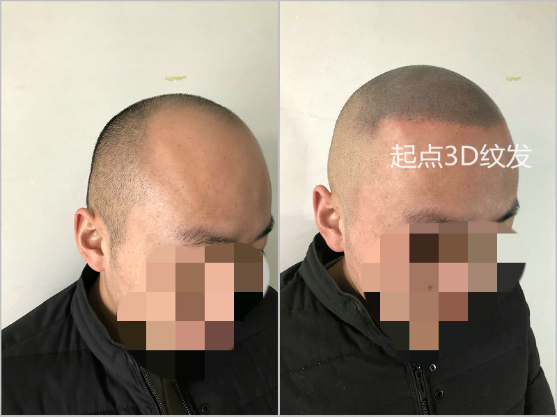 淮安起点纹发作品