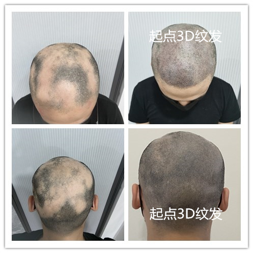 淮安起点纹发作品