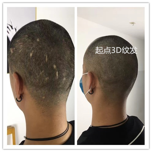 淮安起点纹发作品