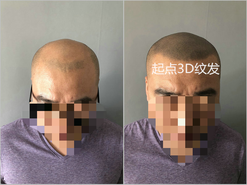 纹发注意事项，纹发后需要注意什么？
