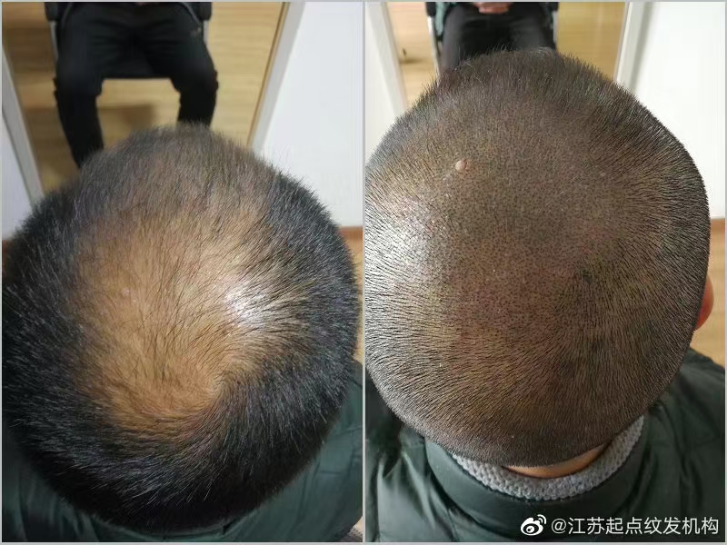 什么是纹发